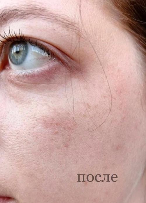 Я просто в шоке, эта пудра сотворила чудо с моим лицом. 02