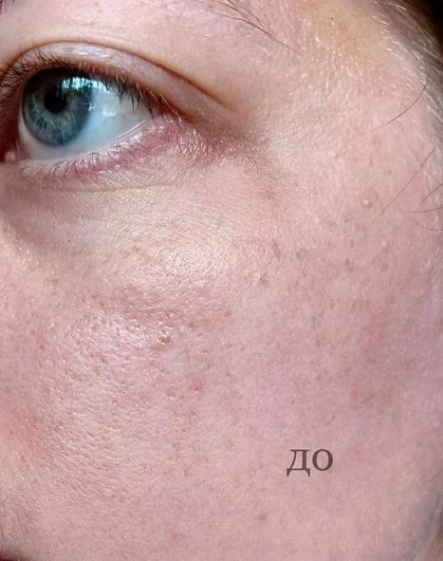 Я просто в шоке, эта пудра сотворила чудо с моим лицом. 01