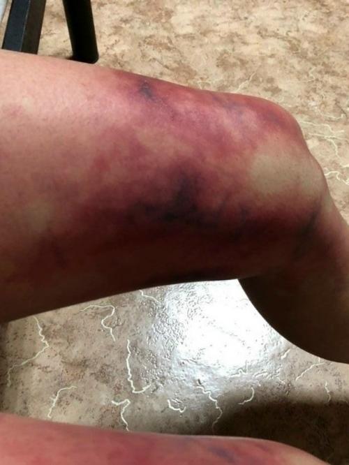 Две девушки решили провести фотосессию в лесу при экстремально низких температурах, достигавших - 35 градусов. 01