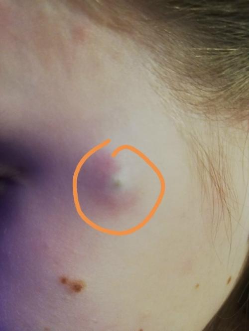 Здравствуйте.  Понимаю, что задавать вопросы о диагнозе в интернете может быть не совсем разумно, но всё же решусь спросить.  