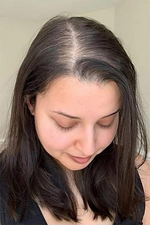 Эта сыворотка от 19lab меня от облысения спасла. 01