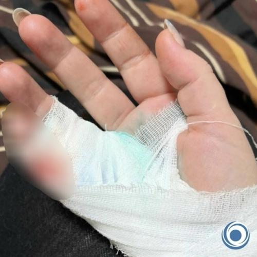 Десятки людей попали в больницу: популярные стеклянные кружки с двойными стенками взрываются при мытье.

