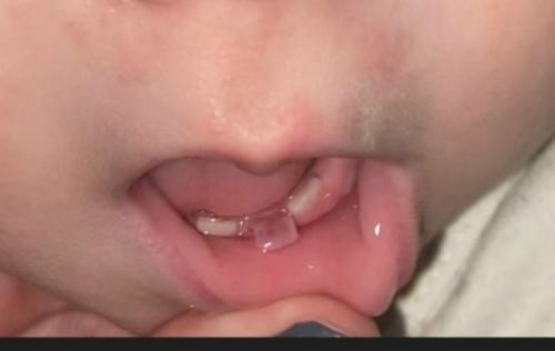 Добрый вечер, ребенок 1, 5 режутся зубы.  