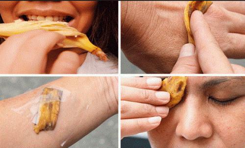 Банановая кожура для пяток. 11 способов применния банановой кожуры в домашнем хозяйстве: от чистки обуви до выведения бородавок